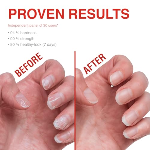 Probelle Nail Strengthener & Growth Treatment - Clear Polish Repair