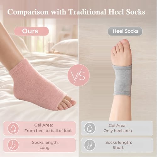 Pink Vigdit Toeless Moisturizing Gel Socks for Dry Cracked Heels Women Gift M