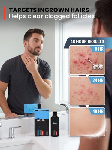 Bump Patrol Max Strength Razor Bump Serum 2 fl oz - Pack of 1
