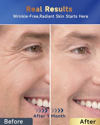 Felicemy 6-in-1 Men’s Face Moisturizer with Retinol, Collagen & Hyaluronic Acid - 1.7 Fl Oz