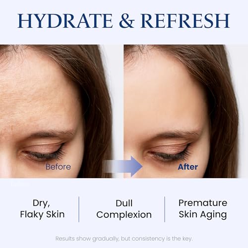 MAXCLINIC Hydrating Moisture Ampoule Serum for Dry Skin | 3.38 fl oz