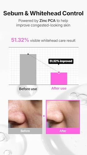 Niacinamide 21% Pore & Oil Control Serum - Hydrating, Lightweight Facial Treatment