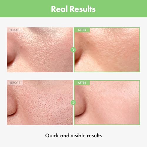 TOSOWOONG Green Tomato Pore Ampoule - Hydrating Face Serum for Skin Tightening
