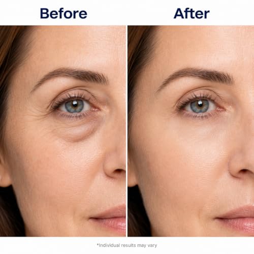 Under Eye Patches for Dark Circles: 30 Pairs Enaskin Naturals Retinol Collagen Eye Gels Mask - Reduce Wrinkles Puffy & Bags - Skin Treatment Pads - Anti Aging Moisturizer For Women (Blue)