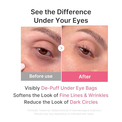 medicube PDRN Pink Collagen Jelly Eye Mask | Hydrogel Eye Patches with PDRN, Collagen, NAD | Refreshing for Puffy, Tired Eyes | Firming for Look of Wrinkles, Fine Lines | Korean Skincare (6 Pairs)