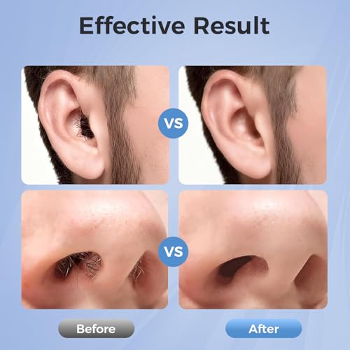 Nose Wax Kit for Men - USB-C Heated Hair Removal with 100g Wax Beans & Travel Bag