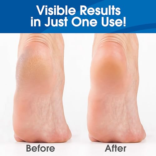 DeEnti Unscented Foot Callus Remover Gel - 16oz Extra Strength