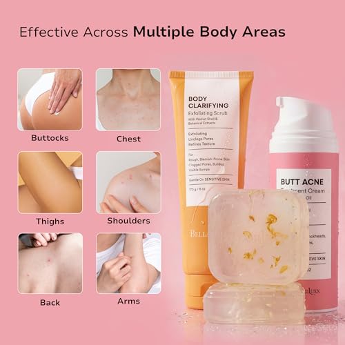 BellamiLuxx Butt Acne Treatment Set: Acne Soap Bar + Butt Treatment Lotion for Breakouts on Buttocks, Thighs, Back, Chest & Ingrown-Prone & Folliculitis-Prone Skin ? Helps Reduce Body Breakouts