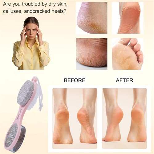 5-in-1 Foot Scrubber Brush & Pumice Stone Pedicure Tool