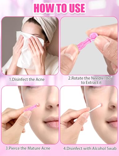 100 Disposable Lancets for Facial Blemish Removal - Pink