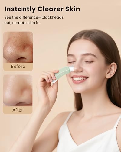 Boloye Dual-Head Blackhead Remover Tool - Stainless Steel Face Scraper