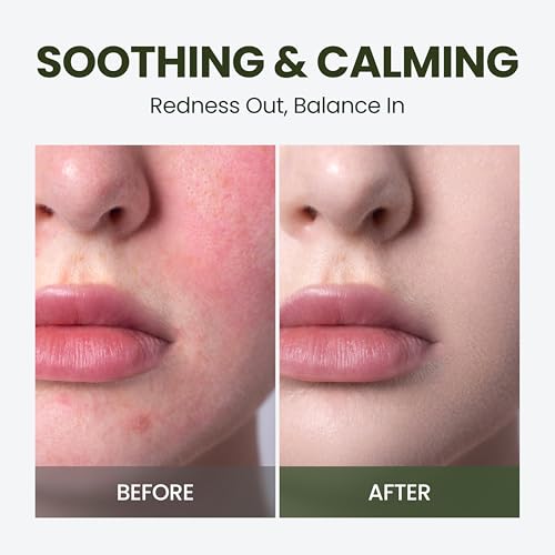Calming Facial Serum with Cica & Hyaluronic Acid - 1.69 oz
