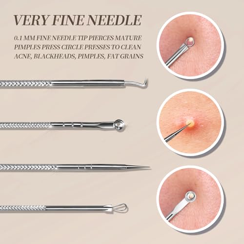 Teenitor Blackhead & Pimple Extractor Tool Kit - Stainless Steel Facial Tweezers & Comedone Removers