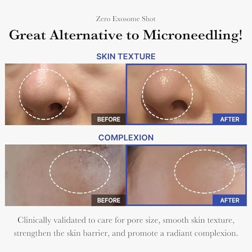 Medicube Exosome Shot 2,000 PPM Facial Serum - Pore & Texture Care Booster