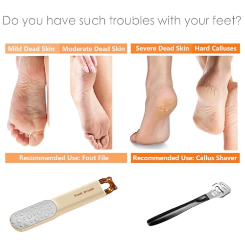 2-in-1 Stainless Steel Foot File & Callus Shaver with 31 Blades
