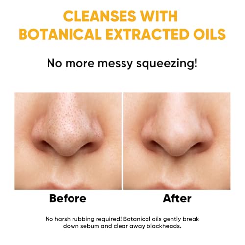 Lopeie 200ml Deep Cleansing Oil for Makeup & Sunscreen Removal – Gentle, Hydrating Facial Cleanser for All Skin Types