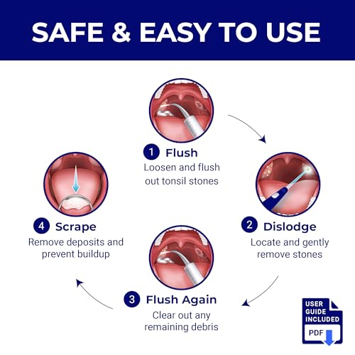ORAVIX Tonsil Stone Removal Kit - 3-in-1 Oral Care Set for Bad Breath