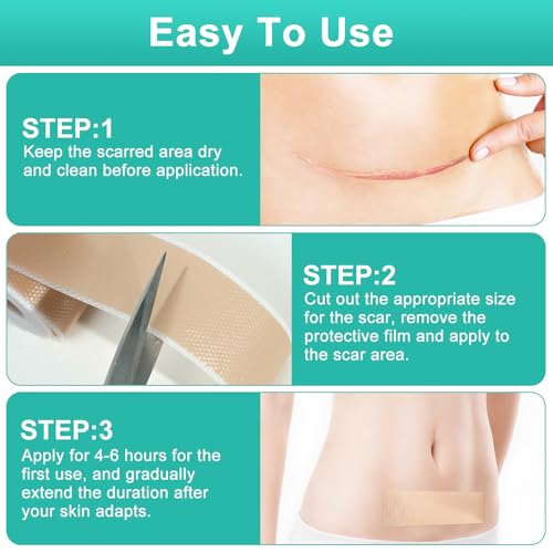 GEAUPASE Silicone Scar Sheets - Reusable 1.6” x 120” Roll for All Scars