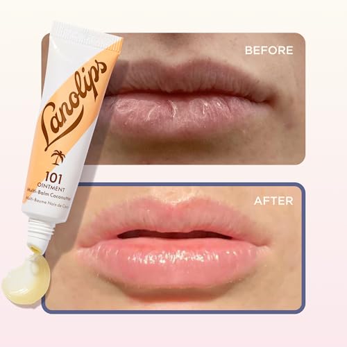 Lanolin 101 Multipurpose Ointment - Lanolin Lip Balm & Healing Ointment for Skin Barrier Repair - Moisturizer for Dry Lips, Cuticles & Elbows - No Petroleum Formula - Coconutter (0.35 oz)