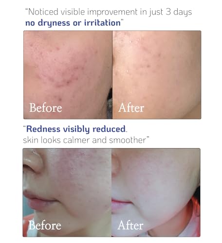 NANO RECIPE Ceramide Concentrate Serum - Barrier Strengthening & Hydrating