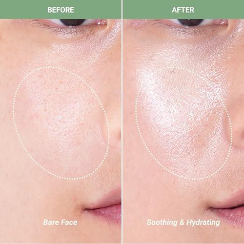Meebak CICA Toner Spray - Soothing Korean Face Mist for Sensitive Skin