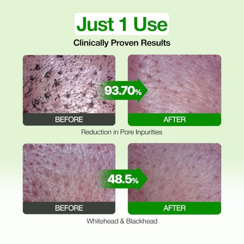 Green Tomato Pore Clay Mask Cleanser - 4.05 Fl Oz - Deep Cleanse