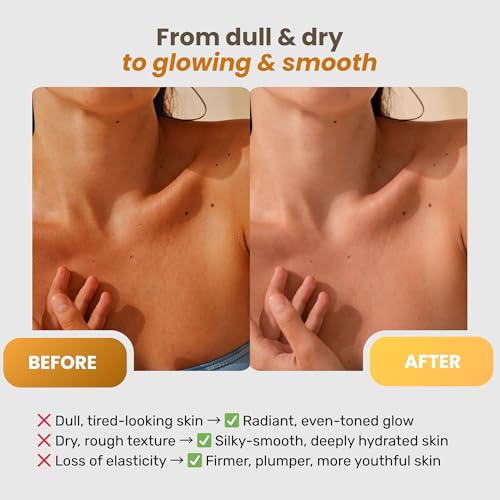 Vitamin C Body Lotion with Collagen & Hyaluronic Acid - Brightening & Firming Moisturizer for Dry Sensitive Skin 6.8 fl oz