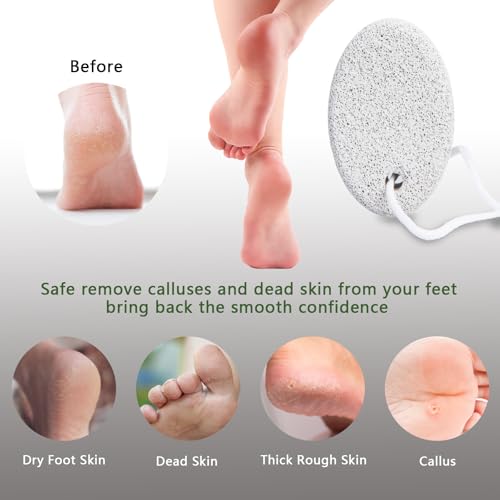 4-Pack Natural Pumice Stone Set for Feet & Hands - Callus Remover
