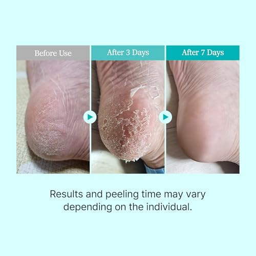 Ariul Smooth & Pure Exfoliating Foot Peel Mask - 2 Pairs with Aloe & Hyaluronic Acid