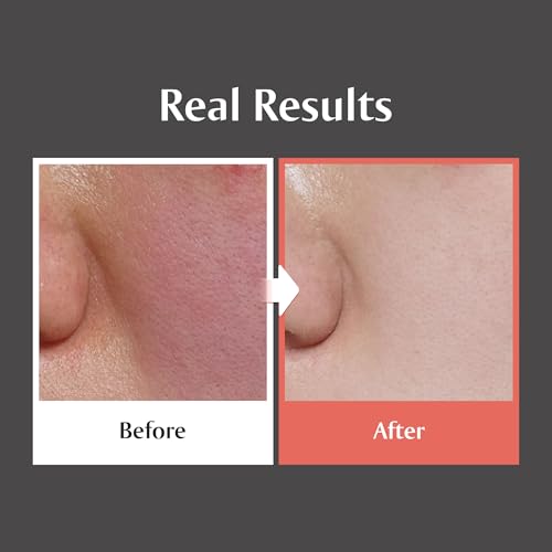 Redence 5% Niacinamide & Triple Hyaluronic Acid Moisturizer - 1.69 fl oz