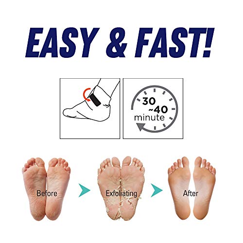 Epielle Foot Peeling & Intensive Repairing Mask Set - 2-Step Foot Care