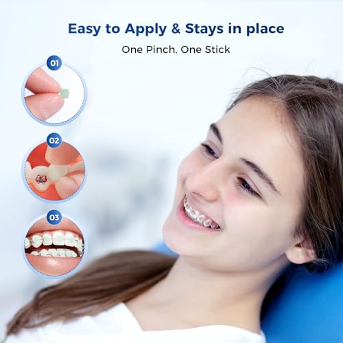 JMU Orthodontic Wax for Braces - 120 Mint Dental Wax Dots