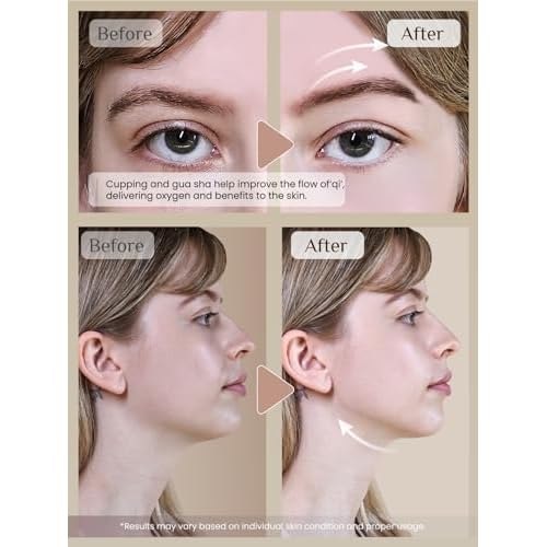 Rena Chris Facial Cupping Set & Gua Sha Facial Tool - Silicone Cupping Set & Rose Quartz Gua Sha Stone - Face Cupping Therapy Sets for Natural Skin Care, Puffiness, Lip Plumping (Pink)