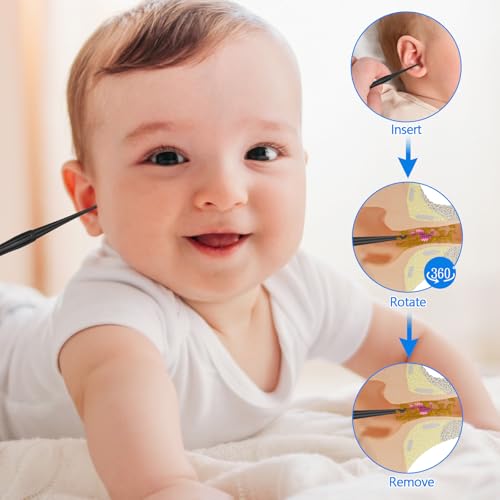 Q-Grips Ear Wax Removal Tool Kit - 6PCS Reusable Ear Cleaners