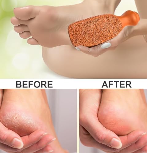 QUBA LINEN 2-Sided Pumice Stone for Feet and Body Care - Exfoliating Callus Remover