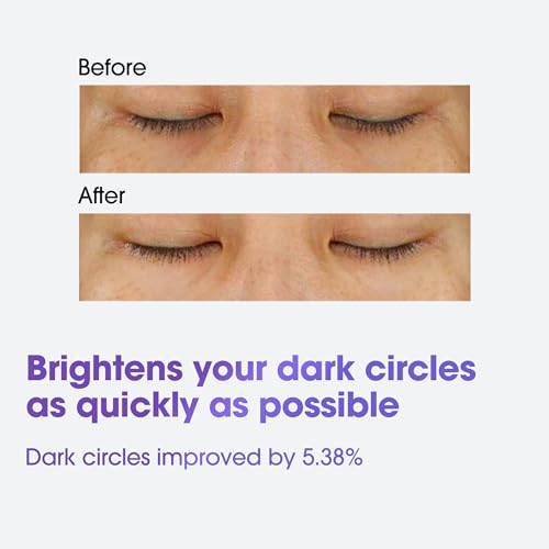 SOME BY MI Retinol Eye Cream Pack of 1 – Brightening Anti-Aging Under Eye Treatment