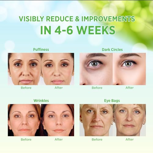 VELAMO ADVANCED Green Under Eye Patches - Aloe Vera & Retinol for Dark Circles, Puffiness & Wrinkles - 60 Pcs