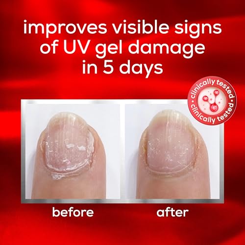essie To The Rescue UV Gel Damage Repair Treatment - 0.46 fl oz