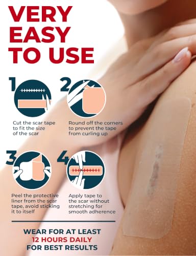 Medical Silicone Scar Sheets - 6 Reusable Strips for C-Section & Keloid Scars