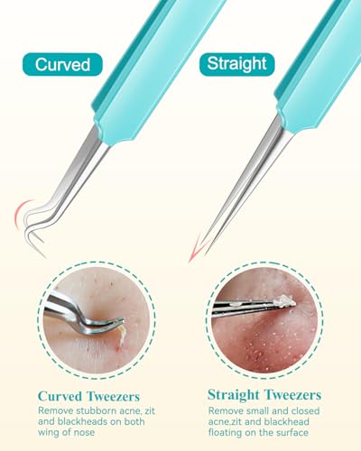 Green MORGLES 10-in-1 Facial Hair & Pimple Tweezers Kit for Women