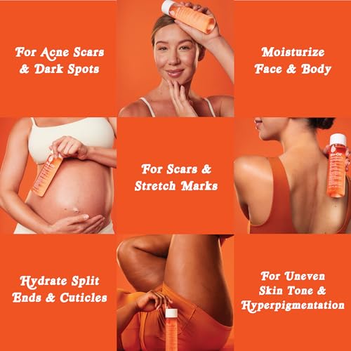 Bio-Oil Skincare Body Oil for Scars & Stretch Marks, 2 fl oz