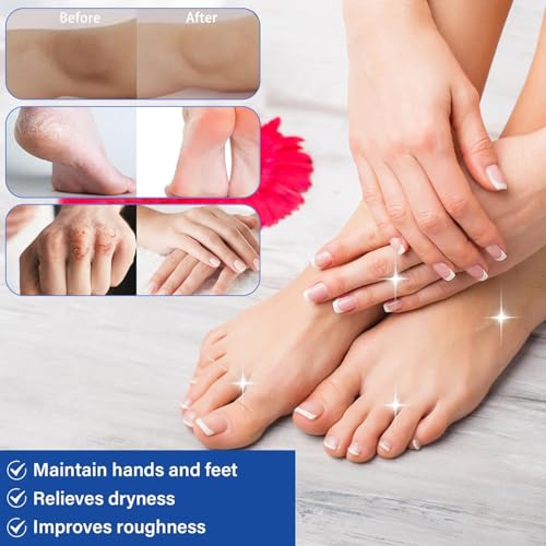 60% Urea Foot Cream with 2% Salicylic Acid for Dry Cracked Heels