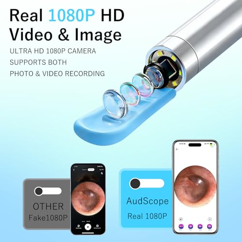 AudScope Black 1080P HD Ear Camera & Wax Removal Kit with LED Lights for Adults & Kids