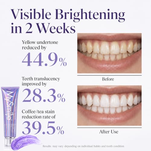 MySmile Purple Whitening Toothpaste for Sensitive Teeth - Fluoride-Free, Enamel Support, Fresh Mint Flavor
