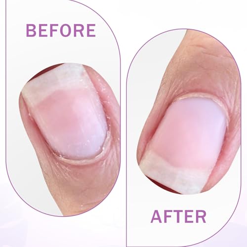 TIESOME Stainless Steel Double-Ended Nail Cuticle Pusher with Sandpaper Sheets - Manicure & Pedicure Tools