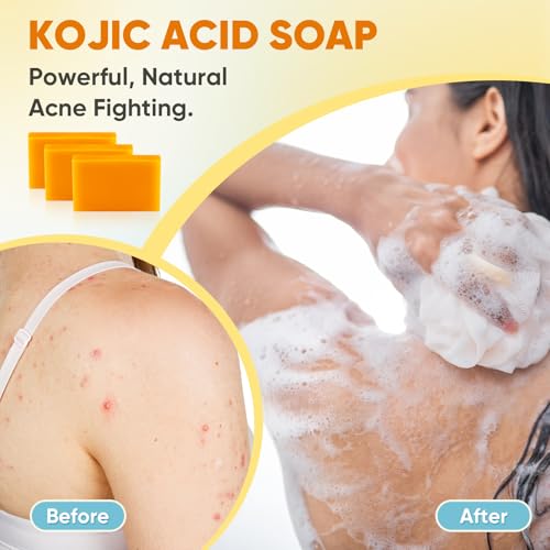 Treeroot Kojic Acid & Turmeric Soap Bar - 5 Pack for Face & Body