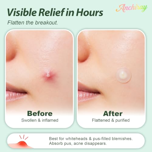 Circle 216 Pcs Acne Patches with Tea Tree Oil Salicylic Acid Calendula - Anchiray