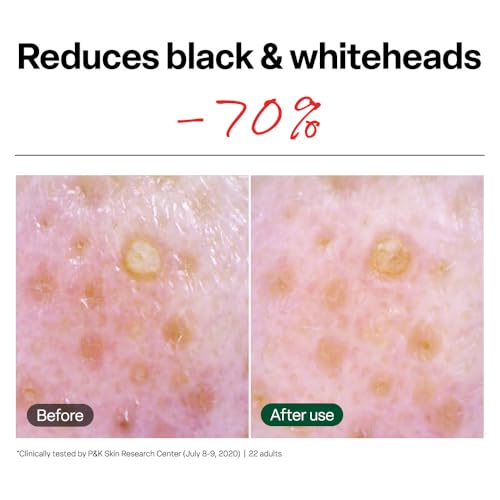 Dr. G Brightening Vita Peeling Pads - 70 Count Exfoliating Face Pads for Skin Brightening and Blackhead Removal