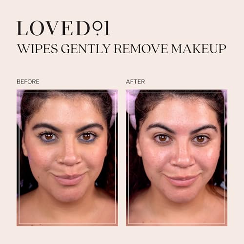 Loved01 Salicylic Acne Wipes 24 Count - Fragrance-Free, Blemish-Prone Skin, Travel & Gym Essential