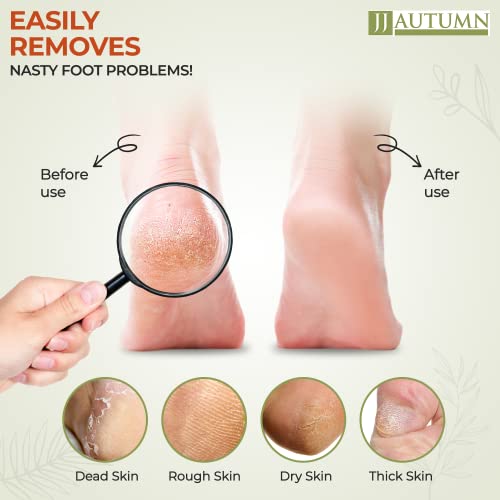 Professional Foot Rasp & Callus Remover - Spa Quality Wooden Pedicure Tool